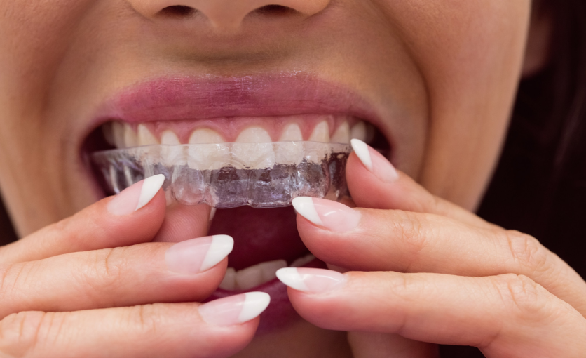 Orthodontic treatment